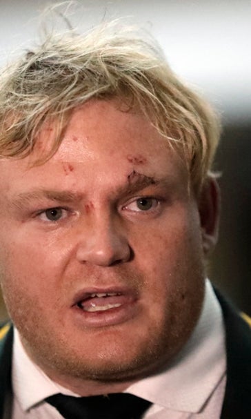 Rock bottom: Springboks at lowest point in years, maybe ever